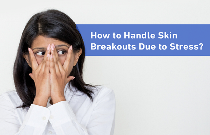 TDH Blog - How to handle skin breakout due to stress
