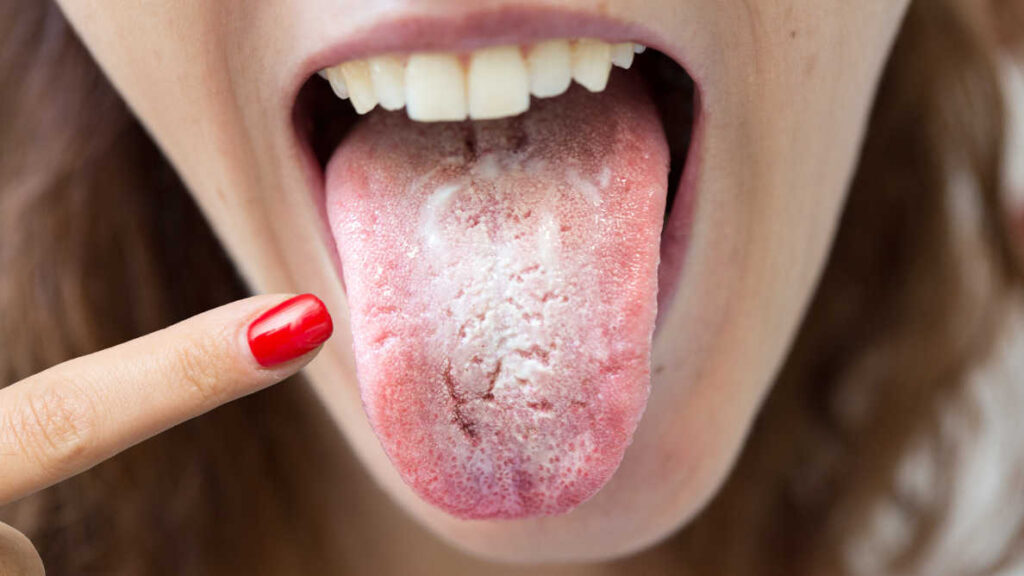 Oral